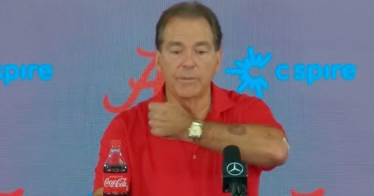 Nick Saban shows off golfball sized bruise from Texas A&M field storming