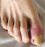 Foot 2.0.jpg