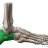 Calcaneus23